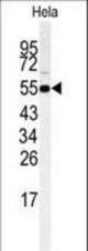Western blot of RIP3 (RIPK3) Antibody in HeLa cell line lysates (35 ug/lane). RIPK3 (arrow) was detected using the purified antibody.