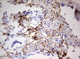IHC of paraffin-embedded Human Ovary tissue using anti-RIPK3 mouse monoclonal antibody. (Heat-induced epitope retrieval by 10mM citric buffer, pH6.0, 120°C for 3min).