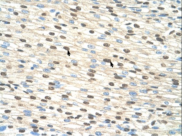 RIPK3 / RIP3 antibody LS-C31844 was used in IHC to stain formalin-fixed, paraffin-embedded human heart.