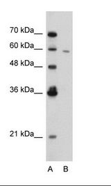 Jurkat Cell Lysate