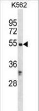 RIPK3 Antibody western blot of K562 cell line lysates (35 ug/lane). The RIPK3 antibody detected the RIPK3 protein (arrow).