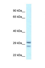 RIT1 antibody LS-C145668 Western blot of 1 Cell lysate. Antibody concentration 1 ug/ml.