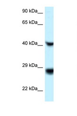 RIT1 antibody LS-C145667 Western blot of ACHN Cell lysate. Antibody concentration 1 ug/ml.