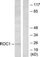Western blot of extracts from Jurkat cells, using RIT1 Antibody. The lane on the right is treated with the synthesized peptide.