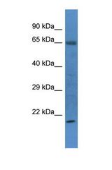 Western blot of Rat Heart. Rit1 antibody dilution 1.0 ug/ml.