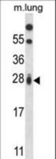 RIT1 Antibody western blot of mouse lung tissue lysates (35 ug/lane). The RIT1 antibody detected the RIT1 protein (arrow).