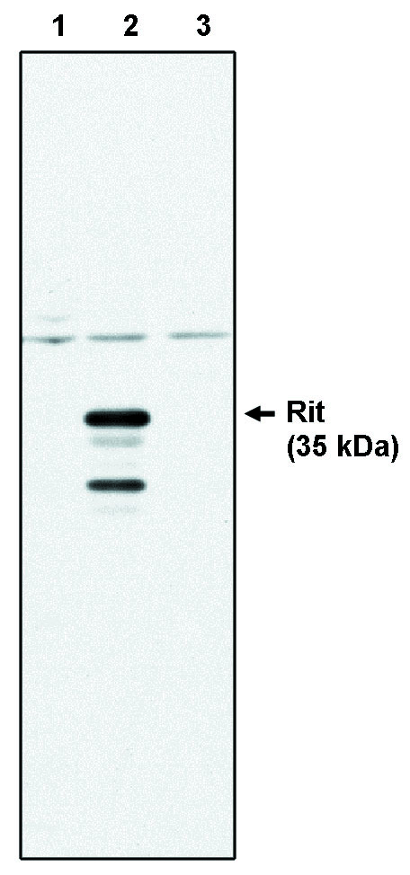 Western blot of Rit antibody (LS-C26663) on control 293 cells (1), 293 cells expressing HA-tagged Rit protein (2) and 293 cells expressing HA-tagged Rin protein (3).