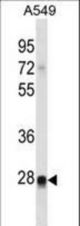 RIT2 Antibody western blot of A549 cell line lysates (35 ug/lane). The RIT2 antibody detected the RIT2 protein (arrow).