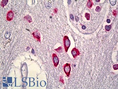 Anti-RIT2 antibody IHC of human brain, cortex. Immunohistochemistry of formalin-fixed, paraffin-embedded tissue after heat-induced antigen retrieval. Antibody LS-B6571 dilution 1:50.