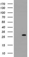 HEK293T cells were transfected with the pCMV6-ENTRY control (Left lane) or pCMV6-ENTRY RIT2 (Right lane) cDNA for 48 hrs and lysed. Equivalent amounts of cell lysates (5 ug per lane) were separated by SDS-PAGE and immunoblotted with anti-RIT2.