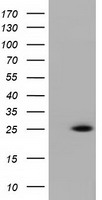 HEK293T cells were transfected with the pCMV6-ENTRY control (Left lane) or pCMV6-ENTRY RIT2 (Right lane) cDNA for 48 hrs and lysed. Equivalent amounts of cell lysates (5 ug per lane) were separated by SDS-PAGE and immunoblotted with anti-RIT2.