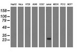 Western blot of extracts (35 ug) from 9 different cell lines by using anti-RIT2 monoclonal antibody.