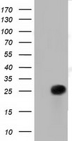 HEK293T cells were transfected with the pCMV6-ENTRY control (Left lane) or pCMV6-ENTRY RIT2 (Right lane) cDNA for 48 hrs and lysed. Equivalent amounts of cell lysates (5 ug per lane) were separated by SDS-PAGE and immunoblotted with anti-RIT2.