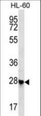 CL052 Antibody western blot of HL-60 cell line lysates (35 ug/lane). The CL052 antibody detected the CL052 protein (arrow).