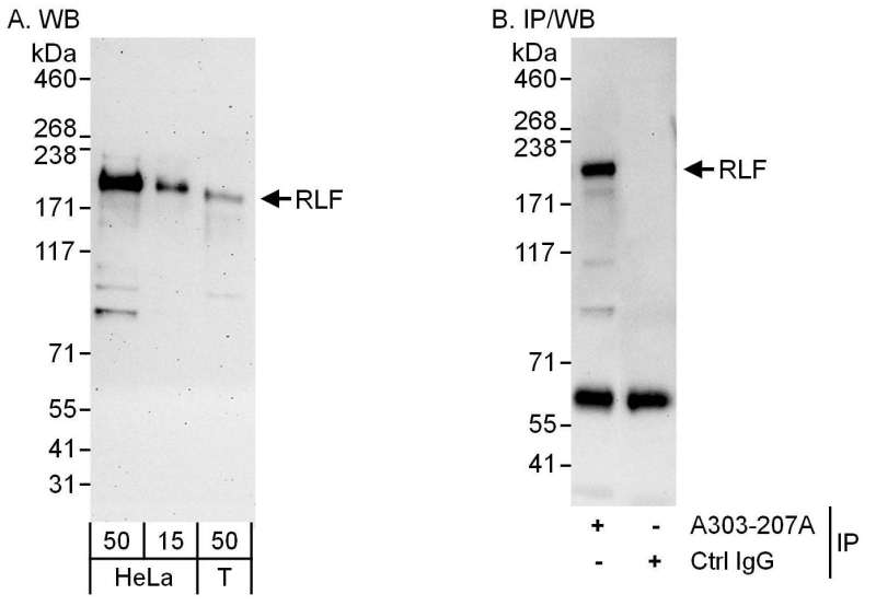 Detection of Human RLF by Western Blot and Immunoprecipitation. Samples: Whole cell lysate from HeLa (15 and 50 ug for WB; 1 mg for IP, 20% of IP loaded) and 293T (T; 50 ug) cells. Antibodies: Affinity purified rabbit anti-RLF antibody used for WB at 0.1 ug/ml (A) and 1 ug/ml (B) and used for IP at 6 ug/mg lysate. Detection: Chemiluminescence with exposure times of 3 minutes (A) and 10 seconds (B).