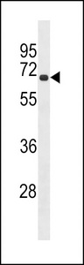 RLIM Antibody western blot of HL-60 cell line lysates (35 ug/lane). The RLIM antibody detected the RLIM protein (arrow).