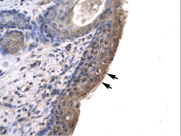 RLIM / RNF12 antibody LS-C29679 was used in IHC to stain formalin-fixed, paraffin-embedded human spermatophore.