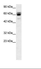Jurkat Cell Lysate