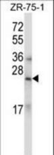 RLN1/RLN2 Antibody western blot of ZR-75-1 cell line lysates (35 ug/lane). The RLN1/RLN2 antibody detected the RLN1/RLN2 protein (arrow).