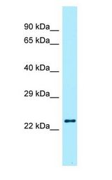 RLN2 / Relaxin 2 antibody Western Blot of HeLa.