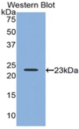 Western blot of recombinant RLN2 / Relaxin 2.
