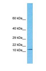 Western blot of RNF5 Antibody with human MDA-MB-435s Whole Cell lysate.