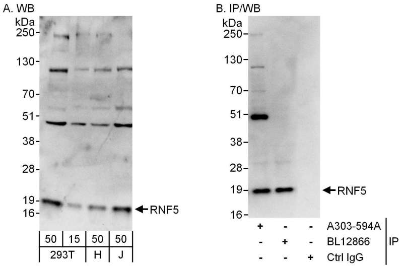 Detection of Human RNF5 by Western Blot and Immunoprecipitation. Samples: Whole cell lysate from 293T (15 and 50 ug for WB; 1 mg for IP, 20% of IP loaded), HeLa (H; 50 ug) and Jurkat (J; 50 ug) cells. Antibodies: Affinity purified rabbit anti-RNF5 antibody used for WB at 0.4 ug/ml (A) and 1 ug/ml (B) and used for IP at 6 ug/mg lysate. RNF5 was also immunoprecipitated by rabbit anti-RNF5 antibody BL12866, which recognizes a downstream epitope. Detection: Chemiluminescence with exposure times of 10 seconds (A) and 3 seconds (B).