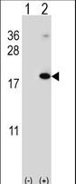 Western blot of RNF5 (arrow) using rabbit polyclonal RNF5 Antibody. 293 cell lysates (2 ug/lane) either nontransfected (Lane 1) or transiently transfected (Lane 2) with the RNF5 gene.