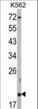 Western blot of RNF5 Antibody in K562 cell line lysates (35 ug/lane). RNF5 (arrow) was detected using the purified antibody.