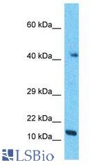 RMND5B antibody Western Blot of A549. Antibody dilution: 1 ug/ml.