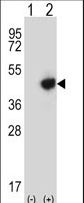 Western blot of RMND5B (arrow) using rabbit polyclonal RMND5B Antibody. 293 cell lysates (2 ug/lane) either nontransfected (Lane 1) or transiently transfected (Lane 2) with the RMND5B gene.