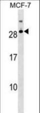 RNASE11 Antibody western blot of MCF-7 cell line lysates (35 ug/lane). The RNASE11 antibody detected the RNASE11 protein (arrow).