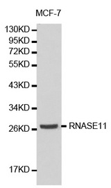 Western blot analysis of MCF-7 cell lysate using RNASE11 antibody.