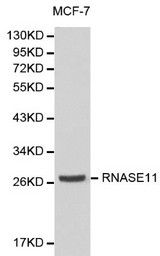 Western blot of RNASE11 pAb in extracts from MCF7 cells.