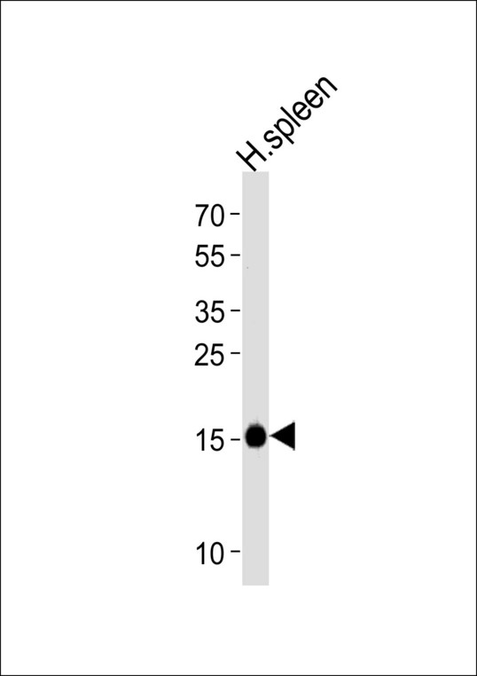 Western blot of lysate from human spleen tissue lysate, using RNASE2 Antibody. Antibody was diluted at 1:1000 at each lane. A goat anti-rabbit IgG H&L (HRP) at 1:5000 dilution was used as the secondary antibody. Lysate at 35ug per lane.