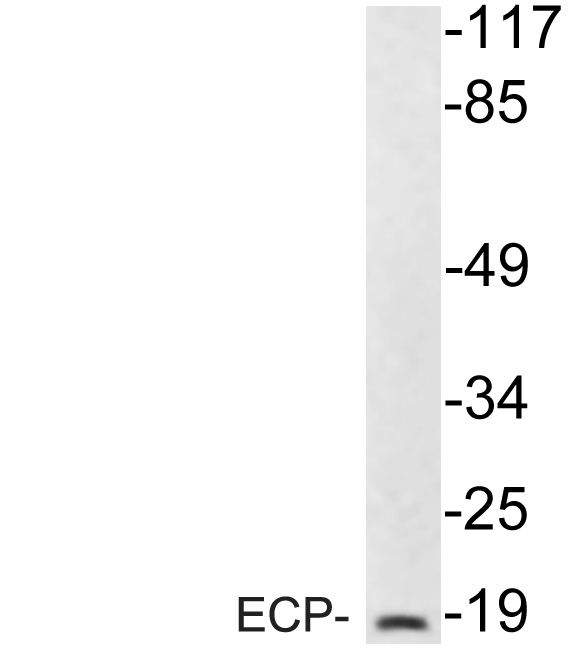 Western blot of ECP (V151) pAb in extracts from 293 cells.
