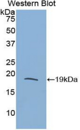Western blot of recombinant RNASE3.