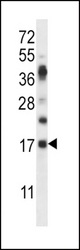 RNASE6 Antibody western blot of mouse heart tissue lysates (35 ug/lane). The RNASE6 antibody detected the RNASE6 protein (arrow).