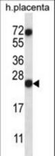 RNASE8 Antibody western blot of human placenta tissue lysates (35 ug/lane). The RNASE8 antibody detected the RNASE8 protein (arrow).