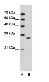 Jurkat Cell Lysate