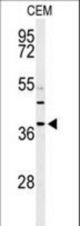Western blot of RNASEH2B Antibody in CEM cell line lysates (35 ug/lane). RNASEH2B (arrow) was detected using the purified antibody.