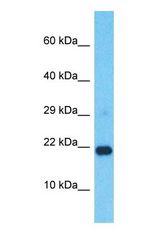 Western blot of RNASEH2C Antibody with Jurkat Whole Cell lysate.