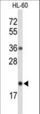 Western blot of RNH2C Antibody in HL-60 cell line lysates (35 ug/lane). RNH2C(arrow) was detected using the purified antibody.