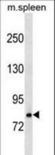 Mouse RNase I Antibody western blot of mouse spleen tissue lysates (35 ug/lane). The RNase I antibody detected the RNase I protein (arrow).