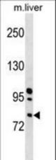 Mouse RNase I Antibody western blot of mouse liver tissue lysates (35 ug/lane). The Mouse RNase I antibody detected the Mouse RNase I protein (arrow).