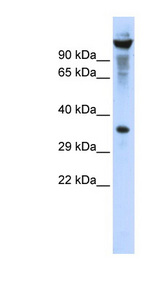 RNASET2 antibody LS-C101428 Western blot of 293T cell lysate.