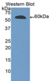 Western blot of recombinant RNASET2.