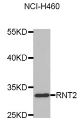 Western blot blot of extracts of NCI-H460 cell line, using RNASET2 antibody.