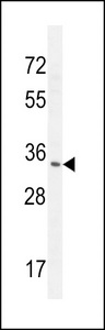 RNT2 Antibody western blot of NCI-H460 cell line lysates (35 ug/lane). The RNT2 antibody detected the RNT2 protein (arrow).