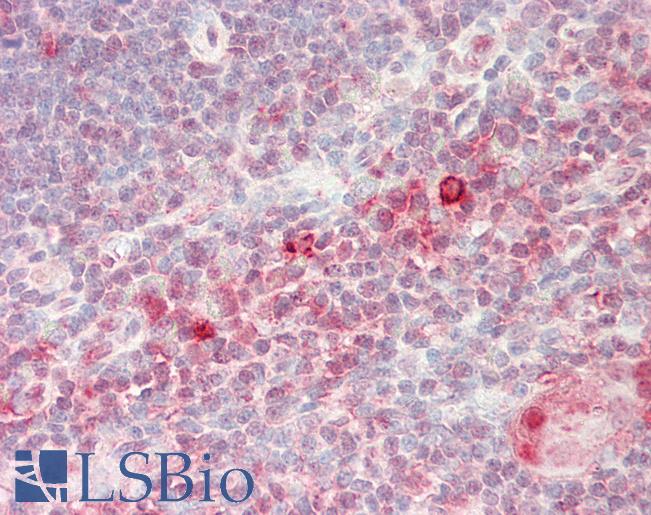 Human Thymus: Formalin-Fixed, Paraffin-Embedded (FFPE)